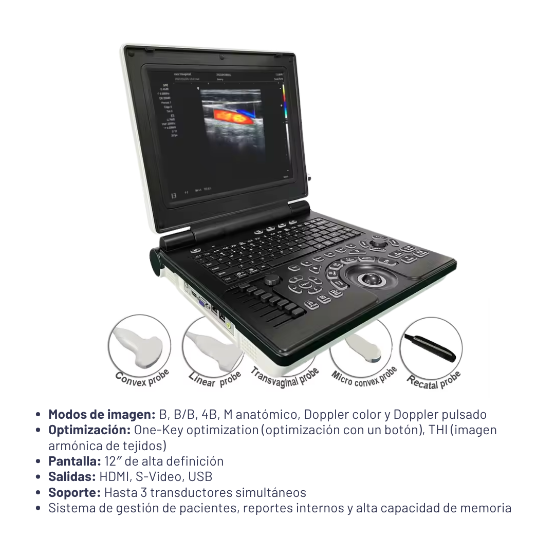 Ultrasonido Portátil con Doppler Color - Sonopro 15